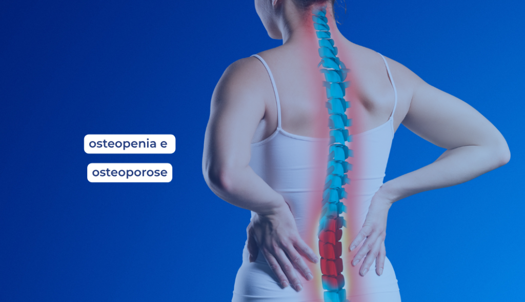 OSTEOPENIA E OSTEOPOROSE